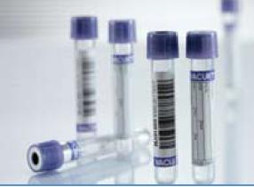 Vacuette® Venous Blood Collection Tube, 3 mL, 13 x 75 mm 454217