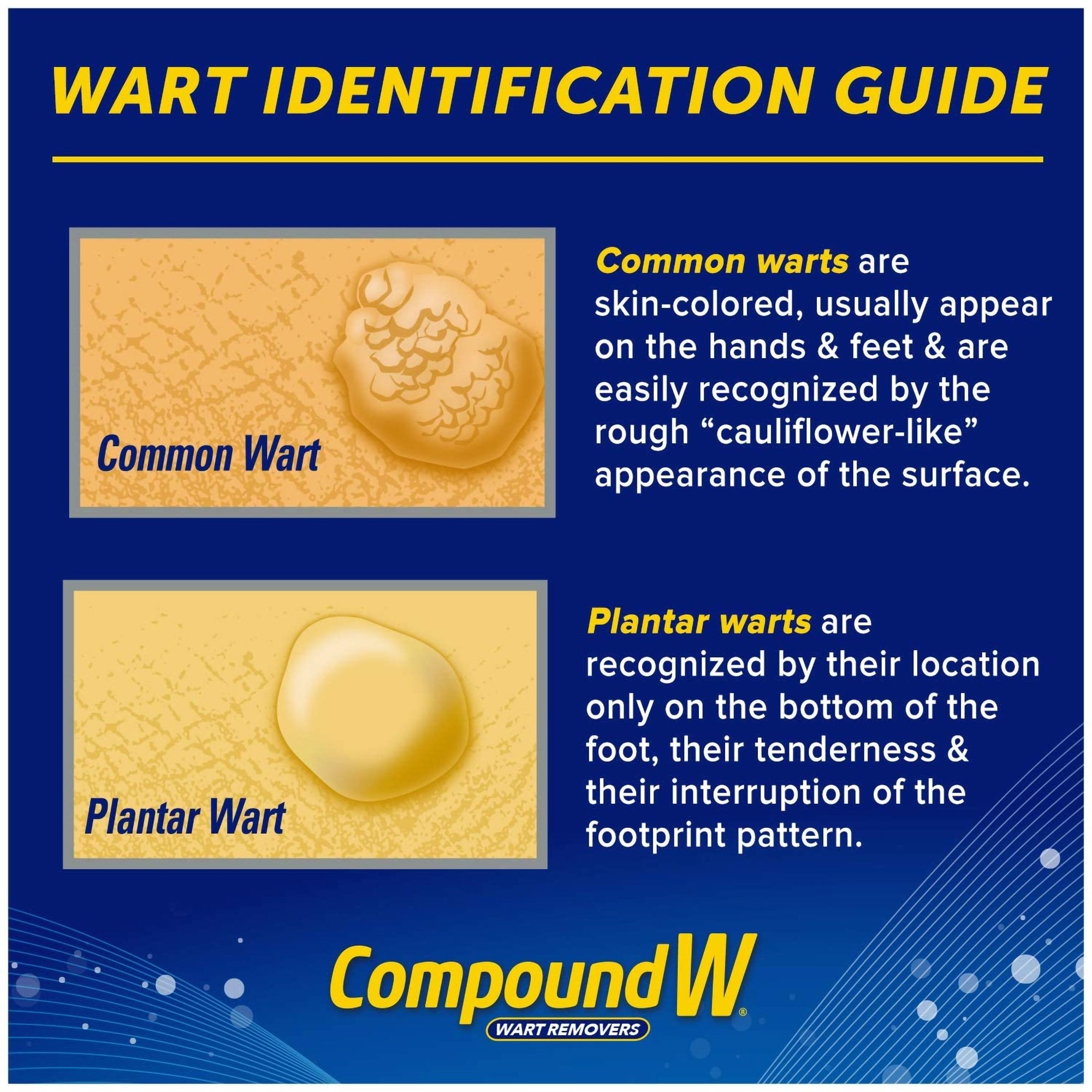 Compound W® Freeze Off® Dimethyl Ether / Propane Wart Remover 07513753005