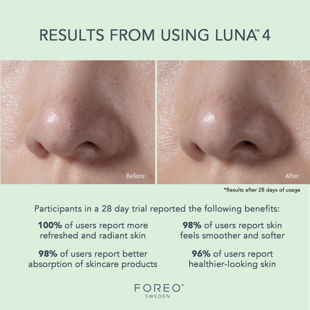 LUNA™ 4 Facial Cleansing Device for Combination Skin F1276
