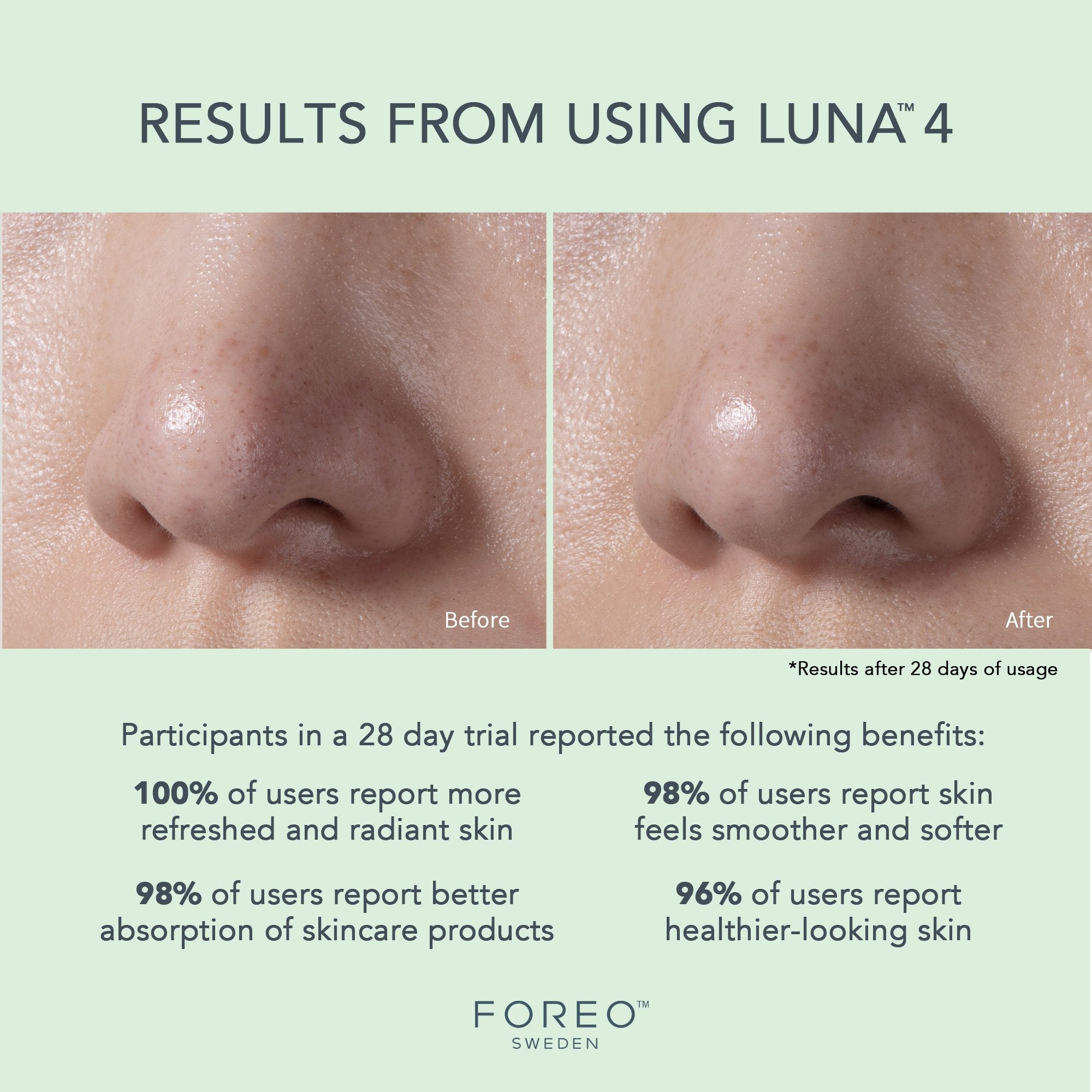 LUNA™ 4 Facial Cleansing Device for Combination Skin F1276