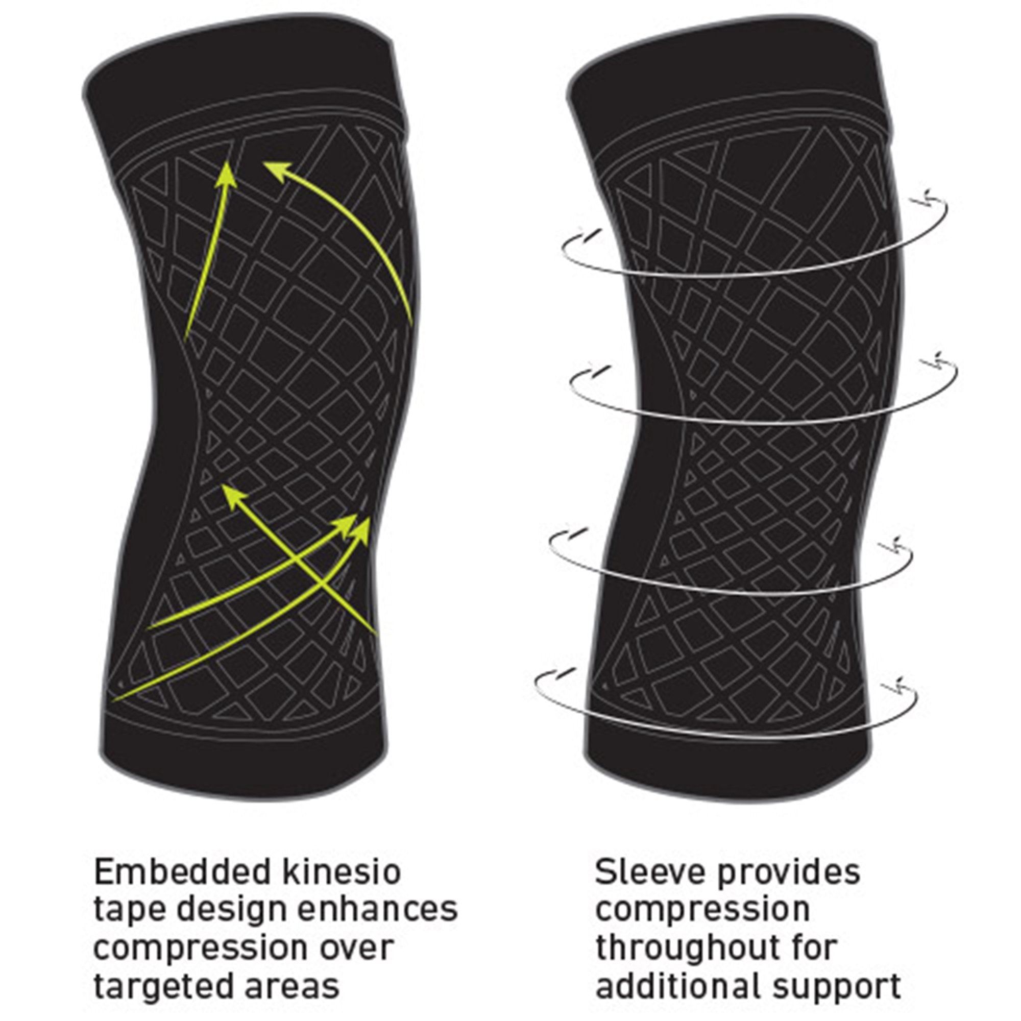 Spark Kinetic Knee Sleeve, Large 40412